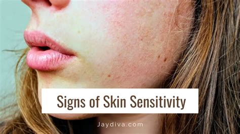 7 Signs Of Skin Sensitivity You Should Know About Jaydiva