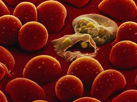 Malaria Parasite Under Microscope Keys To The Avian Malaria Parasites