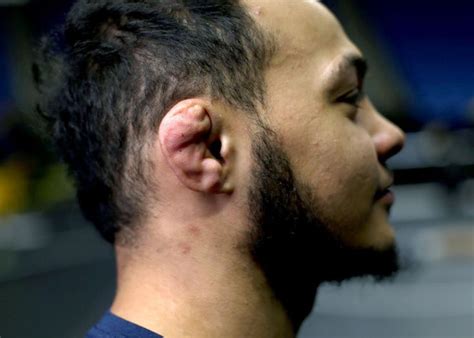 We can play it by ear and decide where to meet later. What causes a cauliflower ear? in 2020 | Jiu jitsu ...