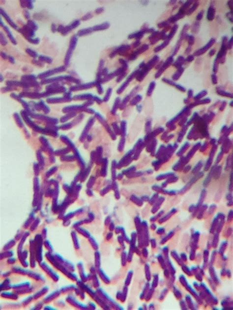 Endospore Stain Clostridium