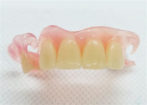 Flexible Partial Dentures Dental Lab Direct