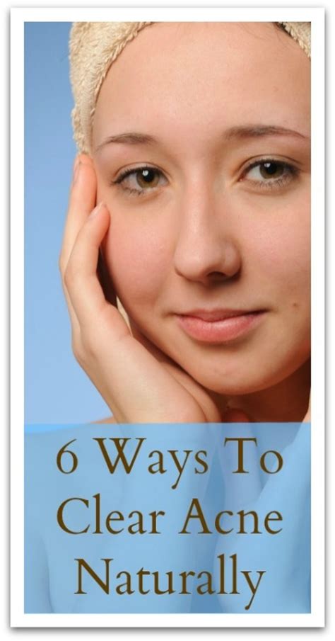 6 Ways To Clear Acne Naturally Natural Holistic Life