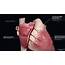 Coronary Artery Anatomy  Blood Supply To The Heart Geeky Medics