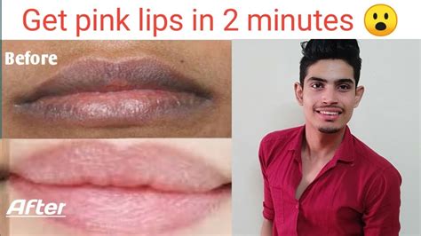 How To Get Permanently Pink Lips In 2 Min How To Get Rid Of Darker
