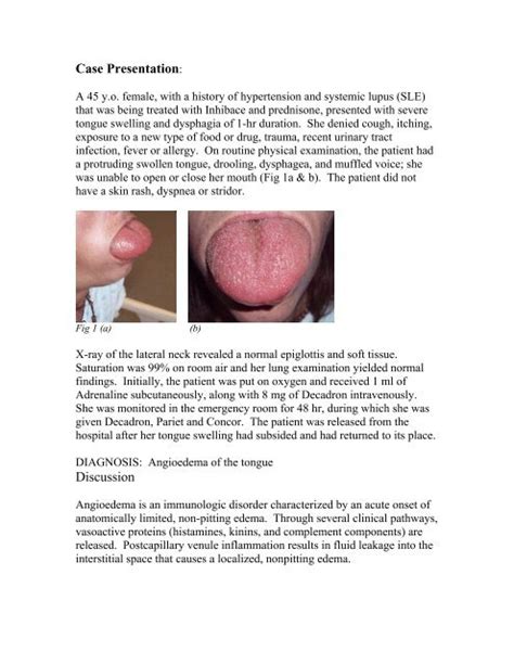 Angioedema Of The Tongue