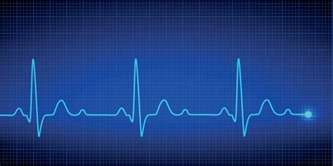 Certified Cardiographic Technician (CCT) Exam - McRee Learning Center