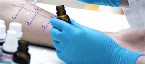 Visite Allergologiche - Studio Radiologico Pandolfo ...