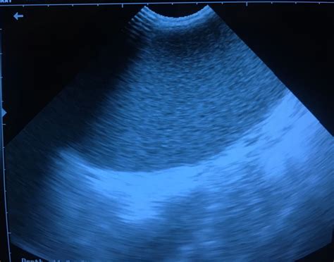 Mad Science — Pyometra In A Dog Pyometra Is A Life Threatening