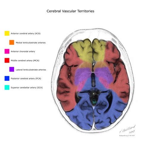 Cerebral vascular territories | Image | Radiopaedia.org