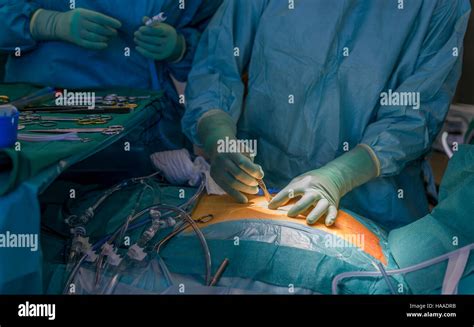 Surgeon Making Incision Heart Valve Replacement Surgery Operating