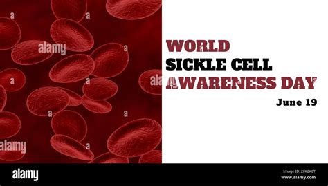 June 19 World Sickle Cell Awareness Day Stock Photo Alamy