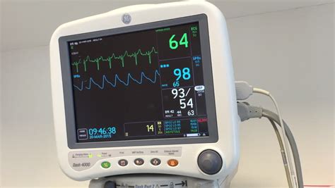 Ecg Monitor Patients Condition In Operating Roomclose Up Heartbeat On