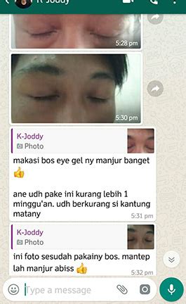 Cara Menghilangkan Mata Panda, Membantu Menghilangkan Mata ...