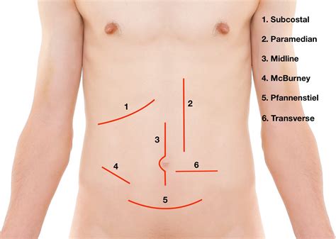 Langers Lines And Surgical Incisions Medical Exam Prep