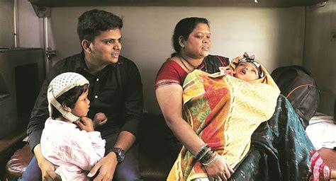 One In 25 Lakh Two Years After Successful Surgery Odisha Conjoined