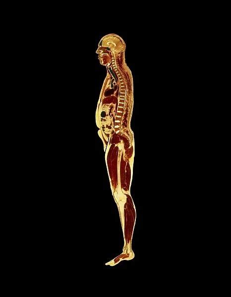 Visible Human Project Sectioned Male Body Side For Sale As Framed