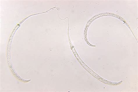 Images Human Parasites Under The Microscope Live Science