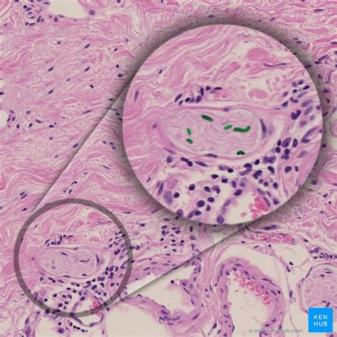 Neuroglia Under Microscope Labeled Micropedia