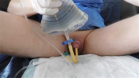 Medical Catheter Tag Top Porn Video Selection Pornogo Tv