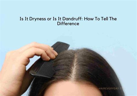 Dandruff Vs Dry Scalp Key Differences Causes And How To Treat Each Hair Everyday Review