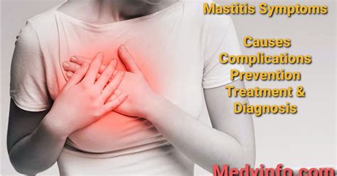 Mastitis Symptoms Causes Complications Prevention Treatment And Diagnosis Medyinfo