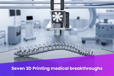 Seven 3d Printing Medical Breakthroughs