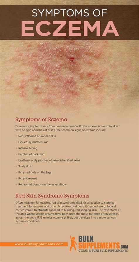Eczema Characteristics Causes And Treatment