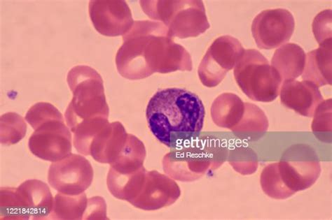 Monocytethe Largest White Blood Cell That Can Transform Into