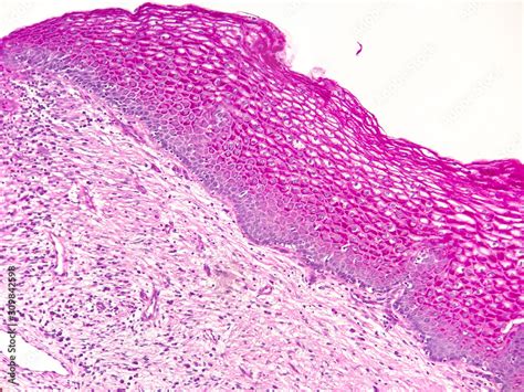 Fototapeta Histology Slide Of A Piece Of Cervix Under Microscope Wit
