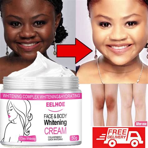 Skin Bleaching