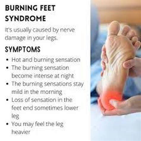 These Are The Symptoms Of Burning Feet Syndrome Medizzy