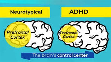What Is Attention Deficit Hyperactivity Disorder Adhd And Attention