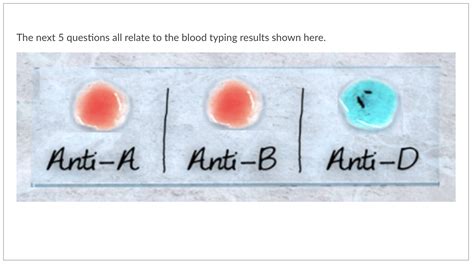 Solved Based On The Blood Typing Results Shown Above Chegg Com