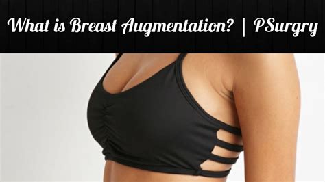 What Is Breast Breast Augmentation Psurgry YouTube