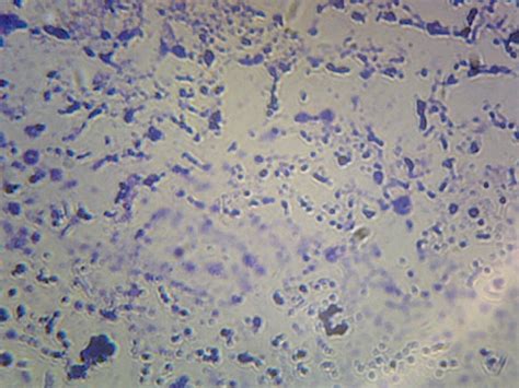 Clostridium Tetani Spore Forming Anaerobic Rods Smear Gram Positive