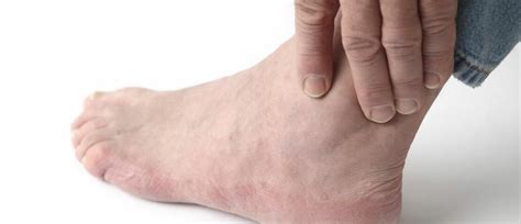 Top Causes Of Swollen Ankles