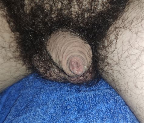 My Hairy Flaccid Cock Tight Foreskin Phimosis 1 Pics Xhamster