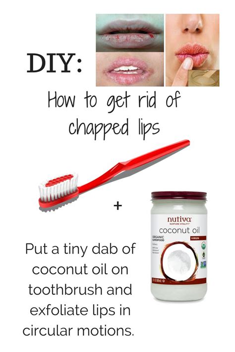 Diy How To Get Rid Of Dry Cracked Chapped Lips Fast Dry Lips Remedy