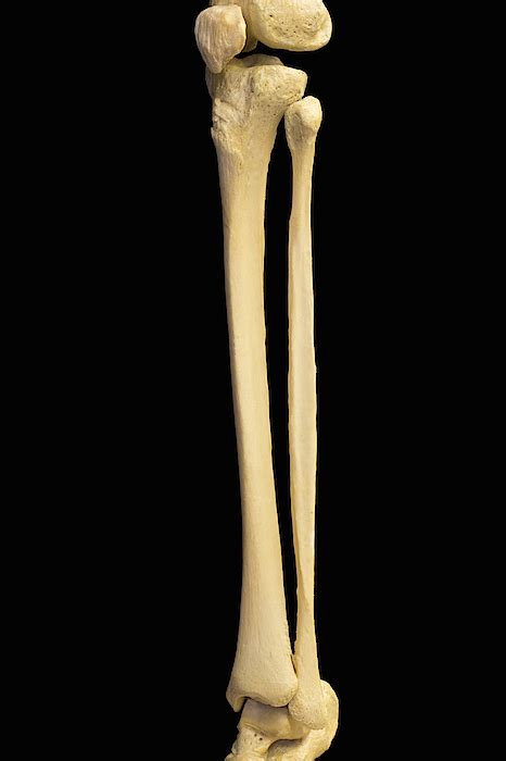 Human Skeleton Showing Lower Leg Bones Greeting Card For Sale By