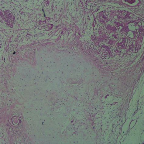 Pdf Mixed Tumor Of Apocrine Sweat Gland In A Terrier Dog