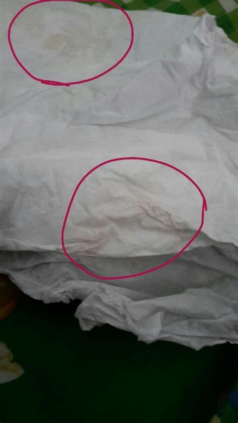 Keluarnya flek coklat saat hamil bisa menandakan perdarahan implantasi atau polip yang tidak berbahaya. Gambar Flek Coklat Kehamilan - GAMBAR TERBARU HD