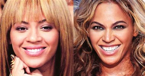 Nose Job Before And After Beyonce Plastic Surgery Before And After