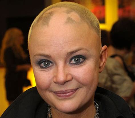 Alopecia Sufferer Gail Porter Has Hair Sprouting On Her Head Again Mirror Online