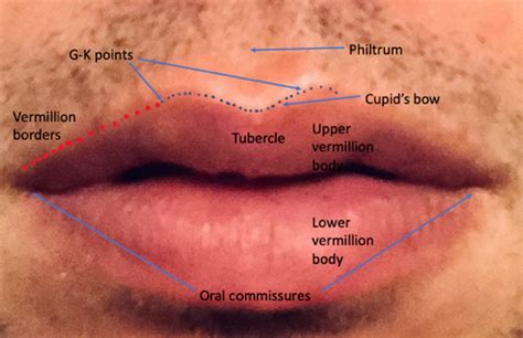 Lip Augmentation Pocket Dentistry