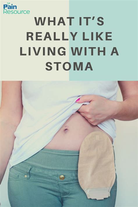 Caz Had A Stoma Put In After A Botched Surgery For Her Stomach Problems This Is Her Life Living