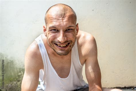 Young Skinny Anorexic Bald Positive And Happy Smiling Homeless Man