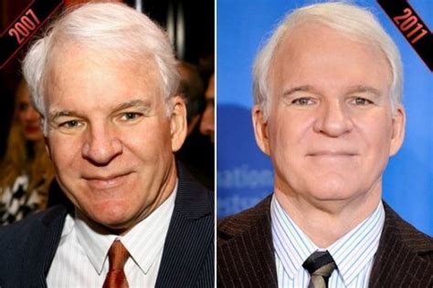Steve Martin Plastic Surgery Before And After Botox And