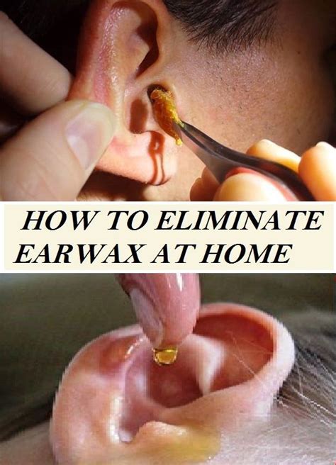 How To Eliminate Earwax At Home Ear Wax Home Health Health