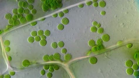 Cyclosis Cytoplasmic Streaming In Plant Cells Elodea Dic