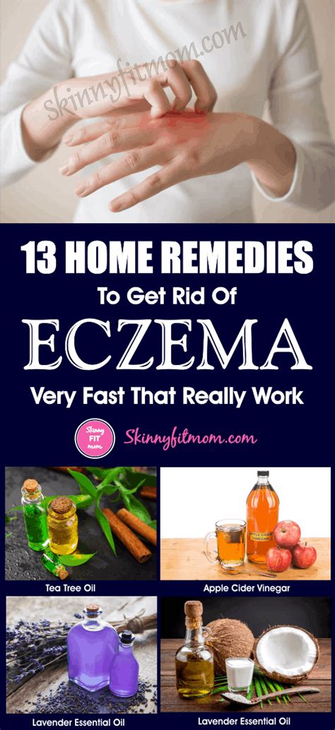 13 Home Remedies To Get Rid Of Eczema Fast That Really Work Get A